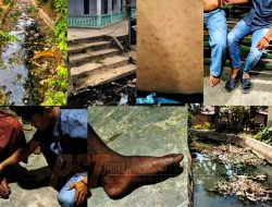 Kekeringan Sungai Bondar Padang Picu Masalah Kesehatan di 10 Desa Padang Lawas