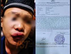 Diduga Santri Dianiaya Atas Perintah Orang Tua, Ibu Korban Laporkan Ke Polres Tapsel